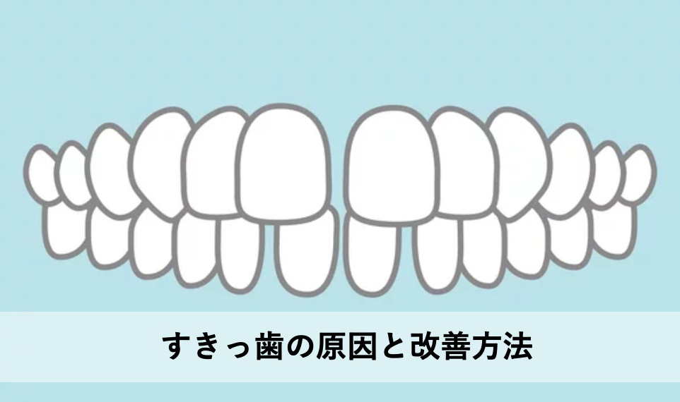 すきっ歯の原因と改善方法